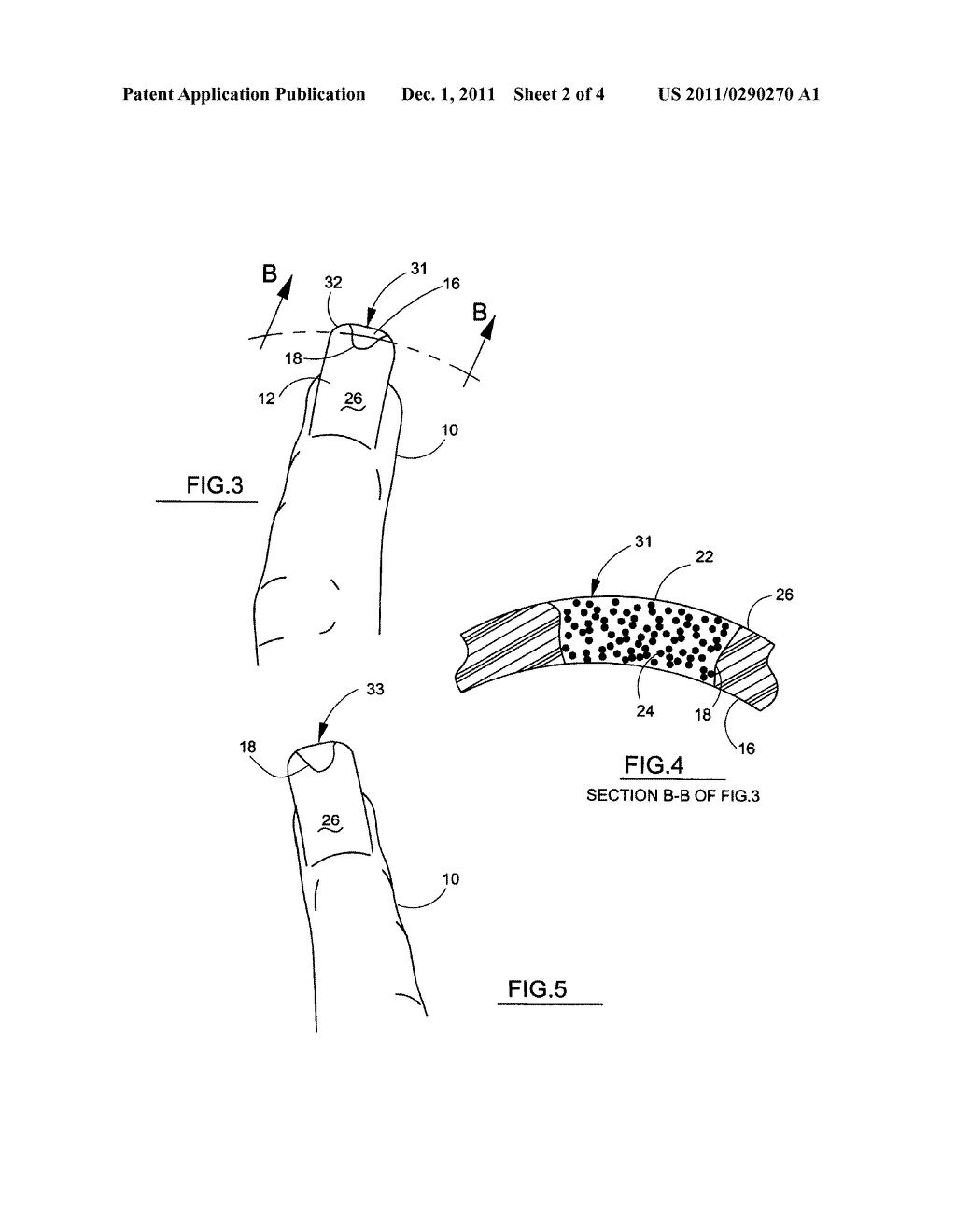 Composition and Method for Aesthetic Repair of Fingernails and Toenails - diagram, schematic, and image 03