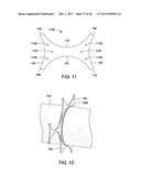 APPARATUS AND METHODS FOR SUPPORTING AN ELONGATED MEMBER diagram and image