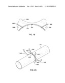 APPARATUS AND METHODS FOR SUPPORTING AN ELONGATED MEMBER diagram and image