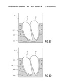 ANATOMICALLY AND FUNCTIONALLY ACCURATE SOFT TISSUE PHANTOMS AND METHOD FOR     GENERATING SAME diagram and image