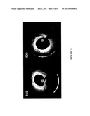 APPARATUS, SYSTEMS, METHODS AND COMPUTER-ACCESSIBLE MEDIUM FOR SPECTRAL     ANALYSIS OF OPTICAL COHERENCE TOMOGRAPHY IMAGES diagram and image