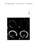 APPARATUS, SYSTEMS, METHODS AND COMPUTER-ACCESSIBLE MEDIUM FOR SPECTRAL     ANALYSIS OF OPTICAL COHERENCE TOMOGRAPHY IMAGES diagram and image