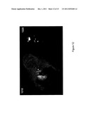 APPARATUS, SYSTEMS, METHODS AND COMPUTER-ACCESSIBLE MEDIUM FOR SPECTRAL     ANALYSIS OF OPTICAL COHERENCE TOMOGRAPHY IMAGES diagram and image