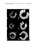 APPARATUS, SYSTEMS, METHODS AND COMPUTER-ACCESSIBLE MEDIUM FOR SPECTRAL     ANALYSIS OF OPTICAL COHERENCE TOMOGRAPHY IMAGES diagram and image