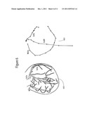 System for Detecting an Invasive Anatomical Instrument diagram and image