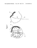 System for Detecting an Invasive Anatomical Instrument diagram and image