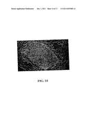 GYNOGENETIC OR ANDROGENETIC PRODUCTION OF PLURIPOTENT CELLS AND CELL     LINES, AND USE THEREOF TO PRODUCE DIFFERENTIATED CELLS AND TISSUES diagram and image