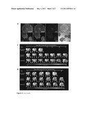 Prevention of immunological rejection of transplanted stem cells by     leukocyte costimulatory molecule blockade diagram and image