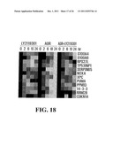 Modulation of Gsk-3Beta and Method of Treating Proliferative Disorders diagram and image