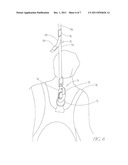 REHABILITATION SUPPORT APPARATUS diagram and image