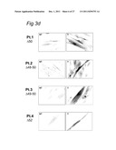 Means and methods for counteracting muscle disorders diagram and image