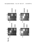 Means and methods for counteracting muscle disorders diagram and image