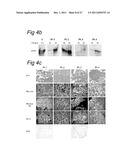 Means and methods for counteracting muscle disorders diagram and image