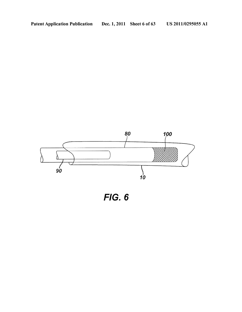 Methods and Devices For The Rerouting Of Chyme To Induct Intestinal Brake - diagram, schematic, and image 07