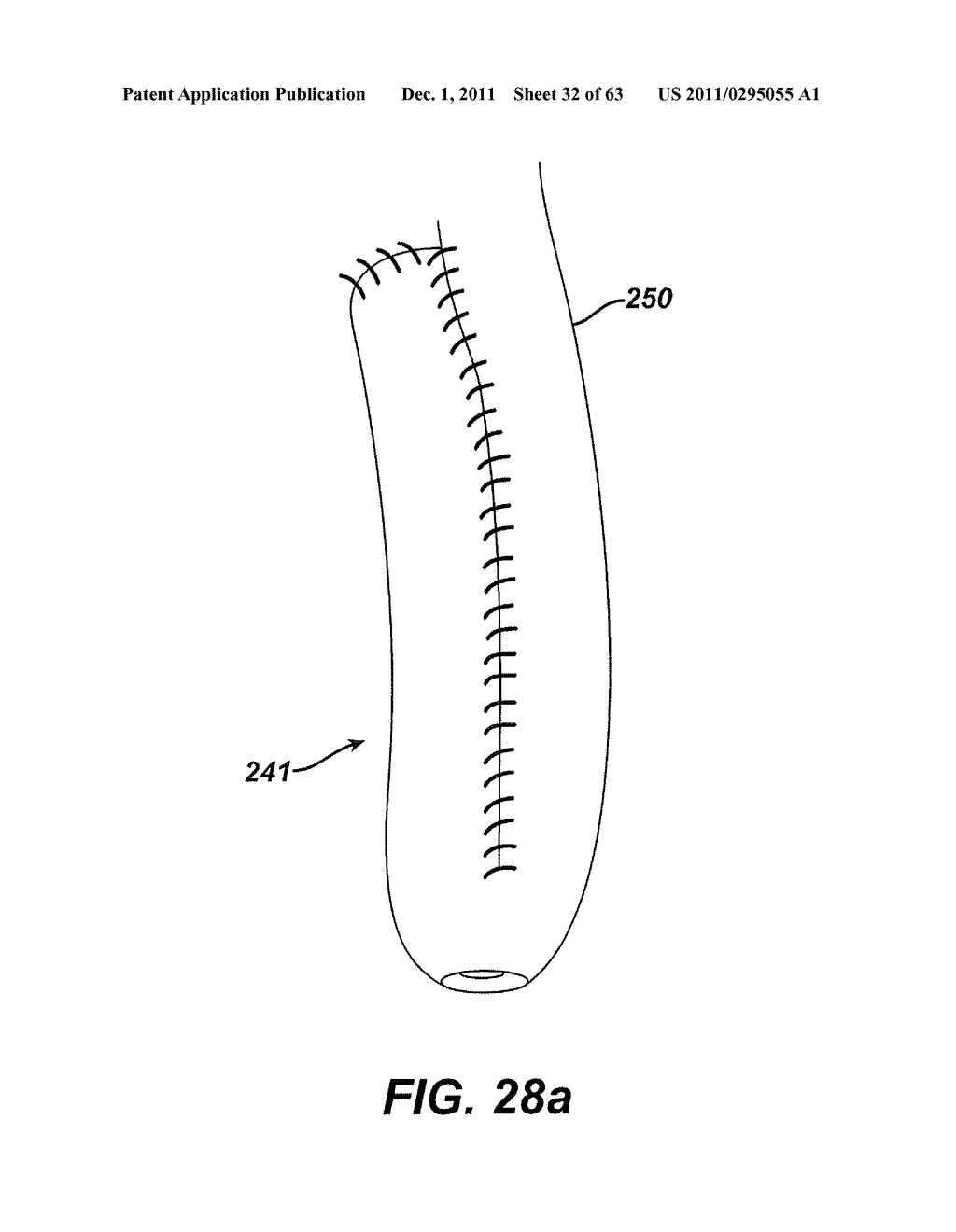 Methods and Devices For The Rerouting Of Chyme To Induct Intestinal Brake - diagram, schematic, and image 33