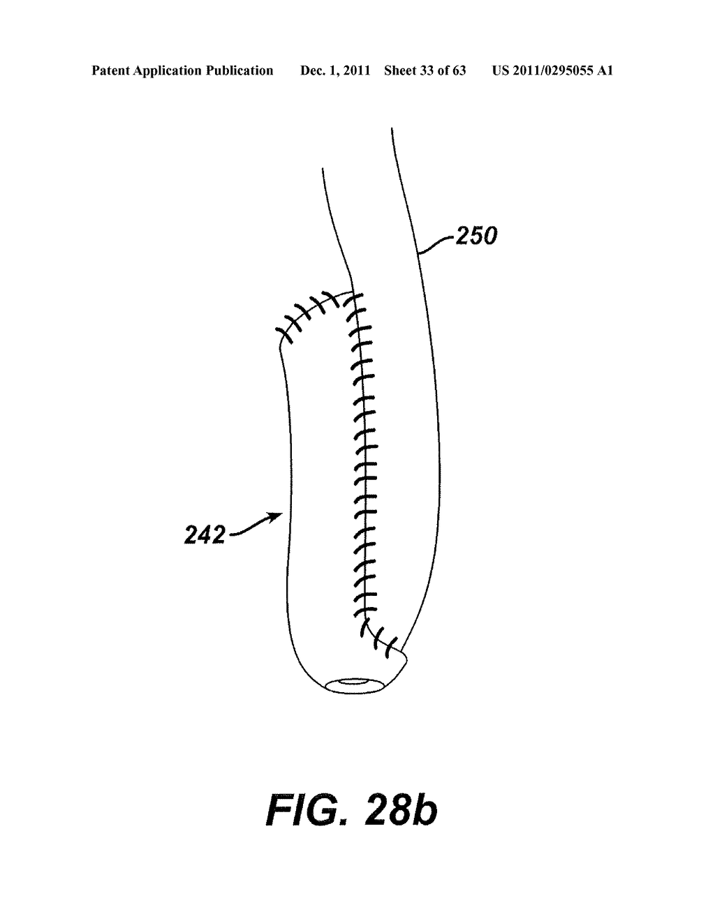 Methods and Devices For The Rerouting Of Chyme To Induct Intestinal Brake - diagram, schematic, and image 34