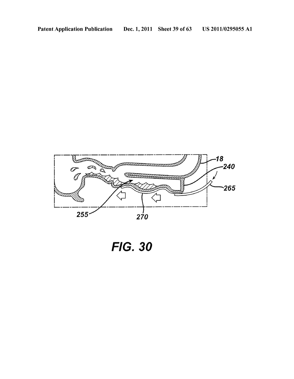 Methods and Devices For The Rerouting Of Chyme To Induct Intestinal Brake - diagram, schematic, and image 40