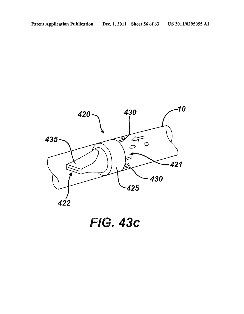 Methods and Devices For The Rerouting Of Chyme To Induct Intestinal Brake - diagram, schematic, and image 57