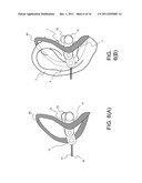 Biologic Information Detecting Apparatus diagram and image