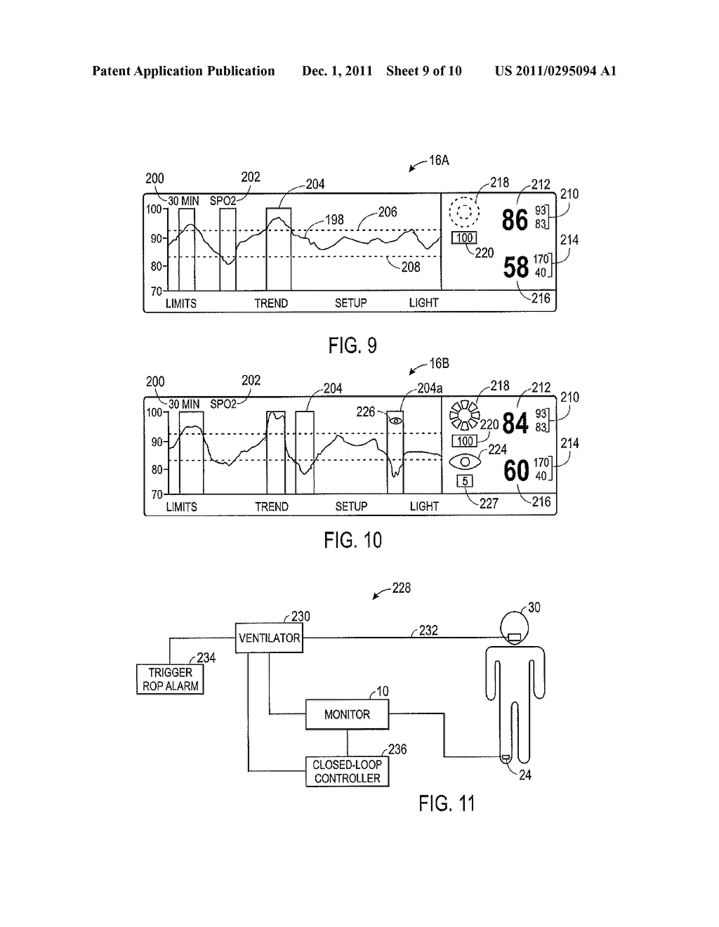 Retinopathy Of Prematurity Determination And Alarm System - diagram, schematic, and image 10