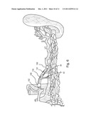 DEVICES, METHODS AND KITS FOR DELIVERY OF THERAPEUTIC MATERIALS TO A     PANCREAS diagram and image