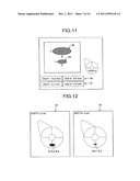 ULTRASOUND DIAGNOSIS APPARATUS AND IMAGE-INFORMATION MANAGEMENT APPARATUS diagram and image