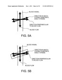 BLOOD-PRESSURE SENSOR diagram and image