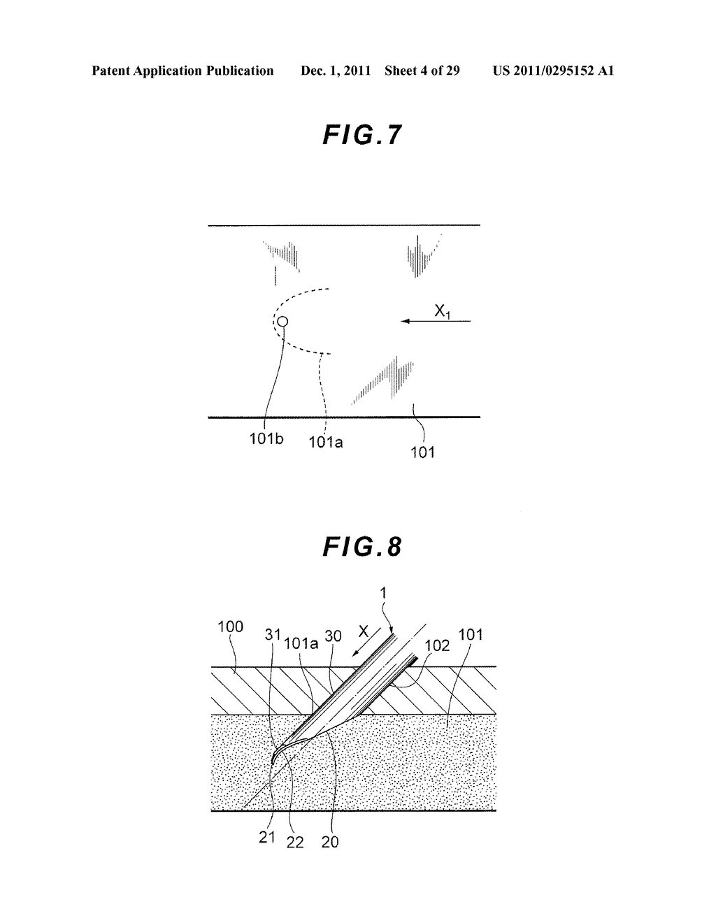 PUNCTURE METHOD, INCISION NEEDLE, PUNCTURE NEEDLE, NEEDLE CAP AND     INSTRUMENT FOR BLOOD PURIFICATION TREATMENT - diagram, schematic, and image 05