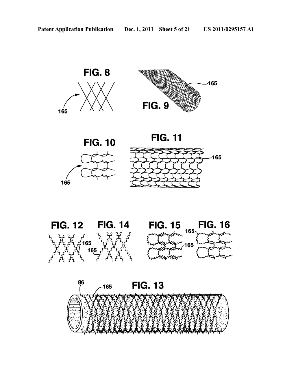 Compliant Blood Vessel Graft - diagram, schematic, and image 06