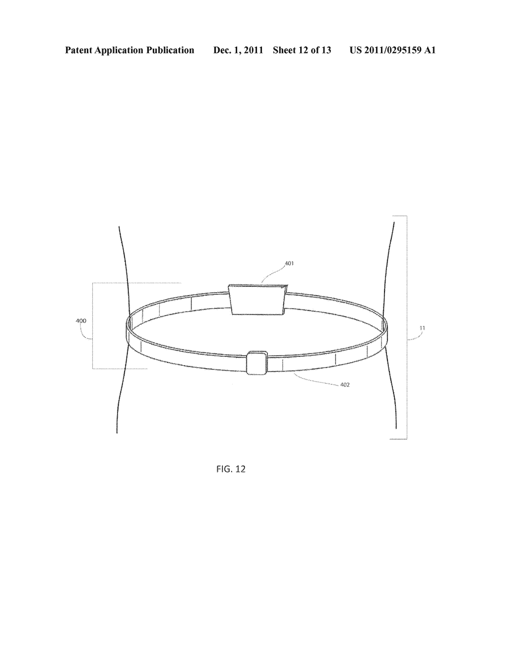 Method and Apparatus for an Implantable Inertial-Based Sensing System for     Real-Time, In Vivo Detection of Spinal Pseudarthrosis and Adjacent     Segment Motion - diagram, schematic, and image 13