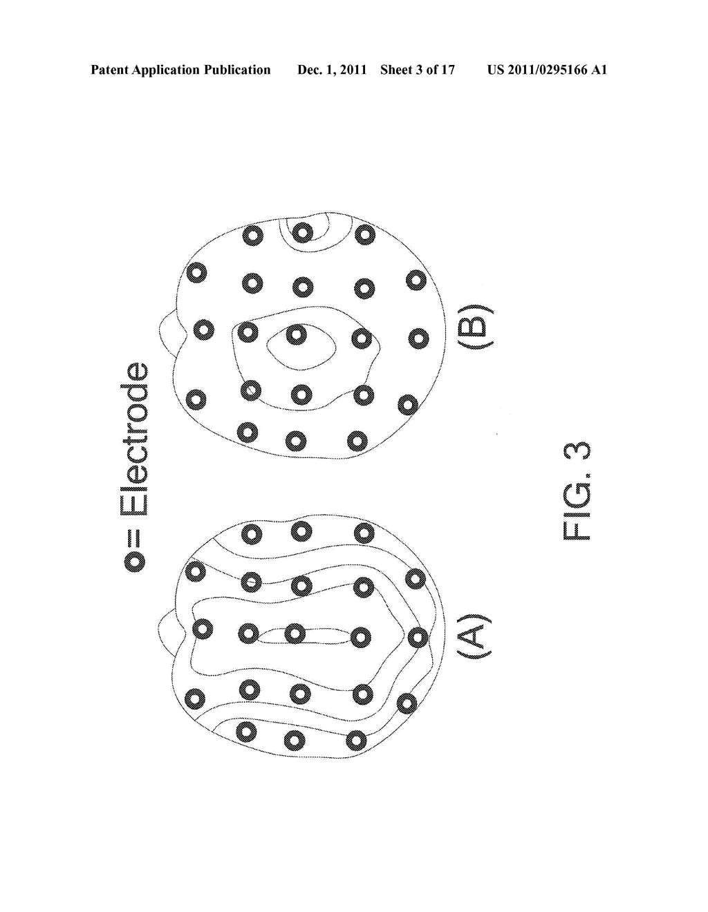 NEUROAUDIOLOGICAL CENTRAL AUDITORY TEST APPARATUS AND METHOD OF     DIFFERENTIATION OF THE NEURAL CORRELATES IN PTSD, TBI, AUTISM, ADHD, ET     AL - diagram, schematic, and image 04