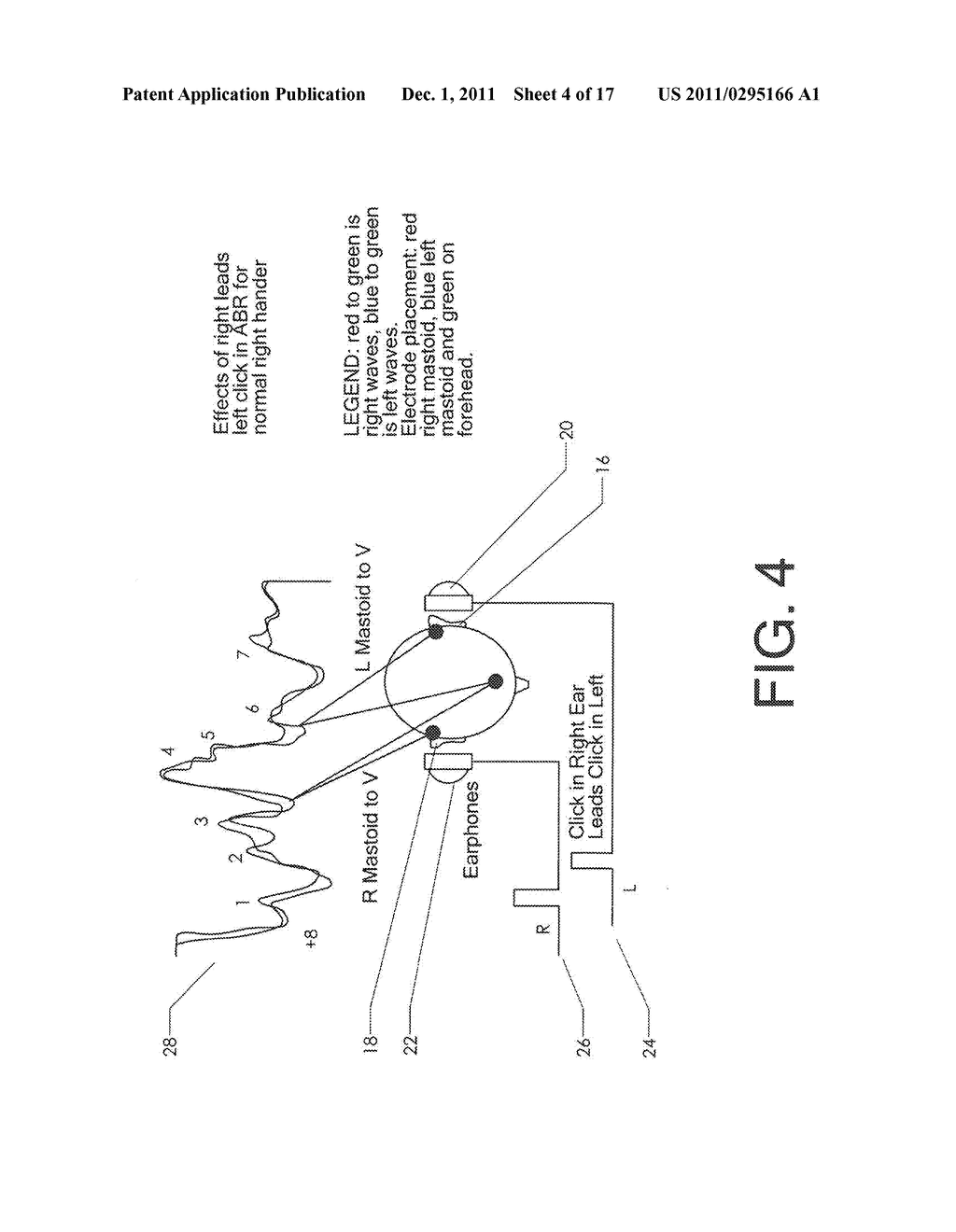 NEUROAUDIOLOGICAL CENTRAL AUDITORY TEST APPARATUS AND METHOD OF     DIFFERENTIATION OF THE NEURAL CORRELATES IN PTSD, TBI, AUTISM, ADHD, ET     AL - diagram, schematic, and image 05