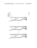 METHOD AND APPARATUS FOR NEGATIVE PRESSURE THERAPY diagram and image