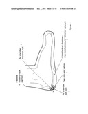 METHOD AND APPARATUS FOR NEGATIVE PRESSURE THERAPY diagram and image