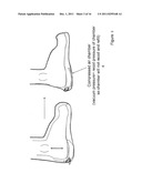 METHOD AND APPARATUS FOR NEGATIVE PRESSURE THERAPY diagram and image