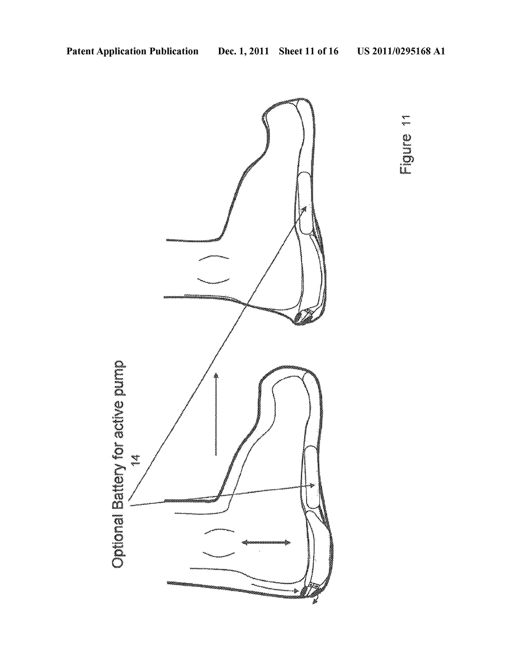 METHOD AND APPARATUS FOR NEGATIVE PRESSURE THERAPY - diagram, schematic, and image 12