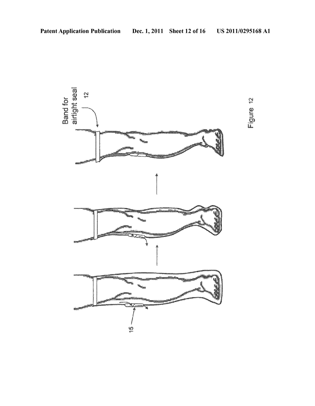 METHOD AND APPARATUS FOR NEGATIVE PRESSURE THERAPY - diagram, schematic, and image 13