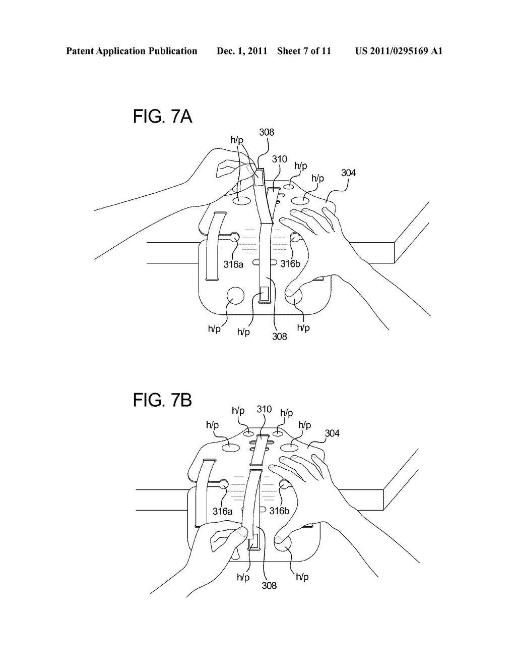 MECHANICALLY ADVANTAGED SPINAL SYSTEM AND METHOD - diagram, schematic, and image 08