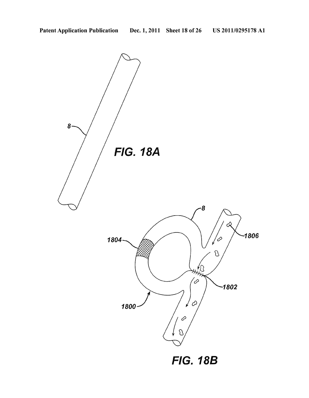 Intestinal Brake Inducing Intraluminal Therapeutic Substance Eluting     Devices and Methods - diagram, schematic, and image 19