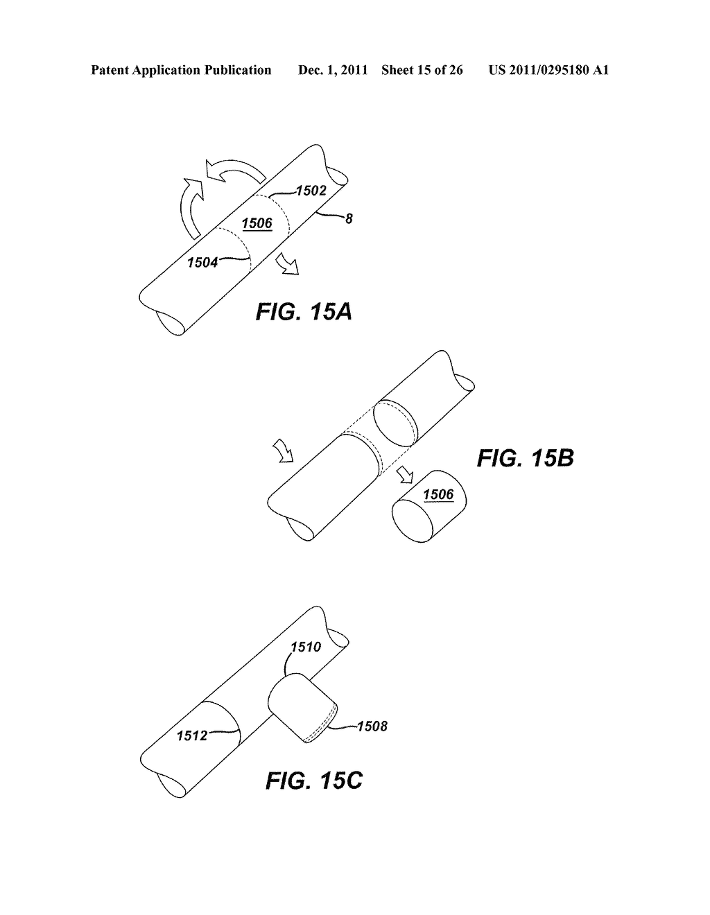 INTESTINAL BRAKE INDUCING INTRALUMINAL THERAPEUTIC SUBSTANCE ELUTING     DEVICES AND METHODS - diagram, schematic, and image 16