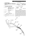 IMPLANTABLE AND REMOVABLE CUSTOMIZABLE BODY CONDUIT diagram and image