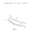 IMPLANTABLE AND REMOVABLE CUSTOMIZABLE BODY CONDUIT diagram and image