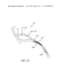 IMPLANTABLE AND REMOVABLE CUSTOMIZABLE BODY CONDUIT diagram and image