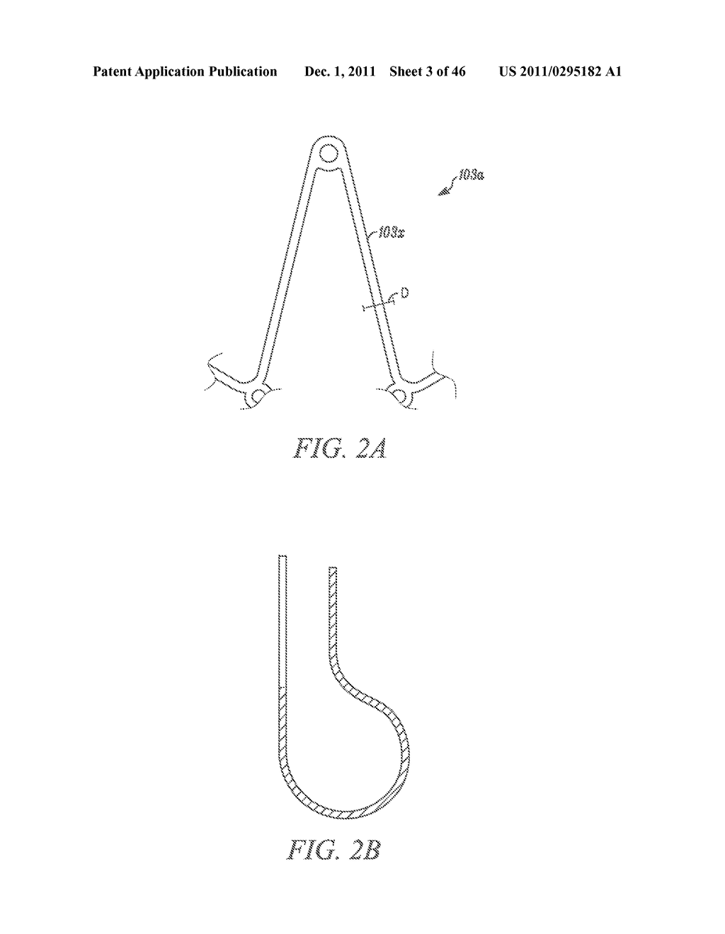 METHODS FOR LOADING A PROSTHESIS - diagram, schematic, and image 04