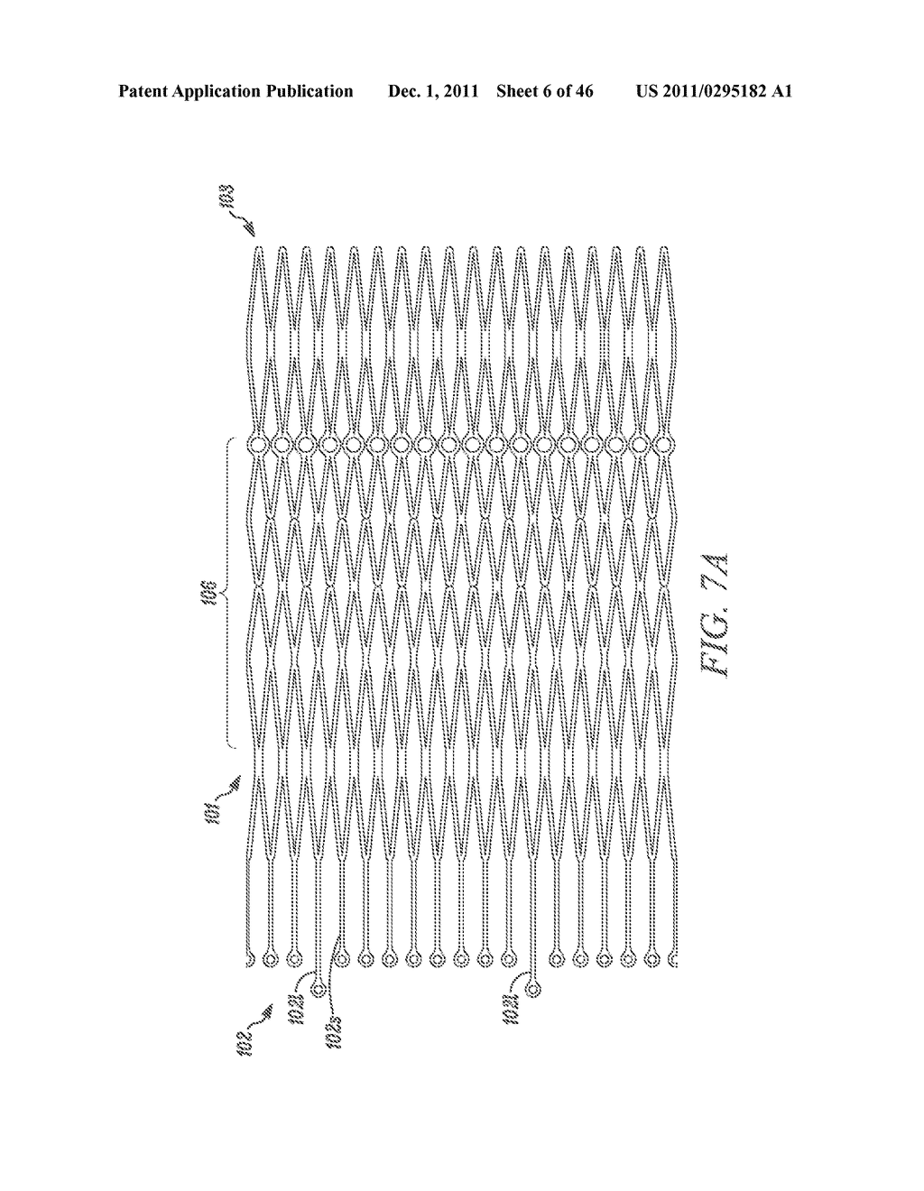 METHODS FOR LOADING A PROSTHESIS - diagram, schematic, and image 07