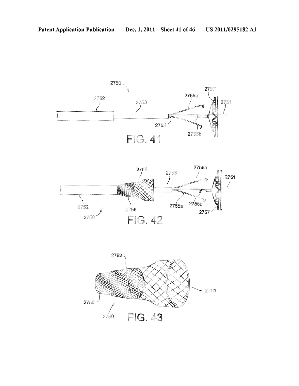 METHODS FOR LOADING A PROSTHESIS - diagram, schematic, and image 42