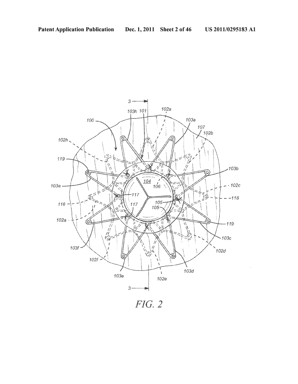 CONTROL DEVICES FOR DEPLOYING A PROSTHESIS - diagram, schematic, and image 03