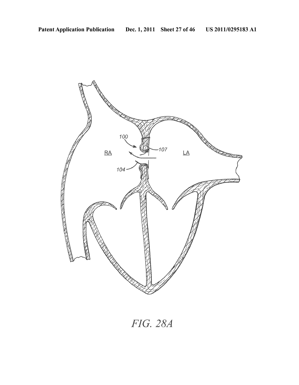 CONTROL DEVICES FOR DEPLOYING A PROSTHESIS - diagram, schematic, and image 28