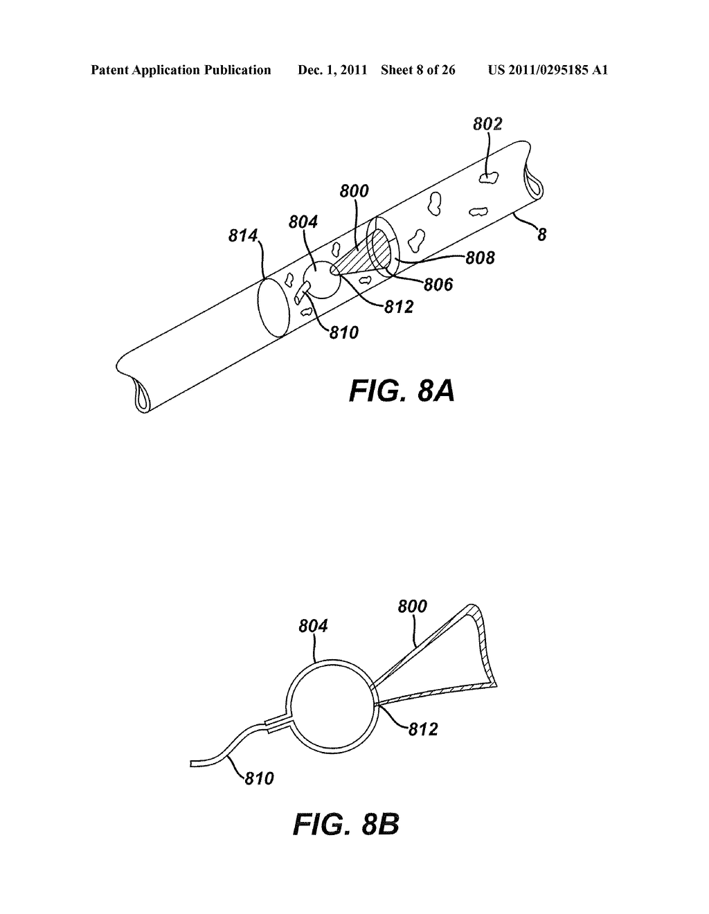 Intestinal Brake Inducing Intraluminal Therapeutic Substance Eluting     Devices and Methods - diagram, schematic, and image 09