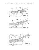 SAFE NEEDLE METHODS, APPARATUS, AND SYSTEMS diagram and image